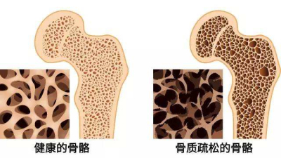 大菠萝福利软件儀