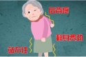 大菠萝福利软件治療儀老年人骨質疏鬆的治療方法,如何預防骨質疏鬆症