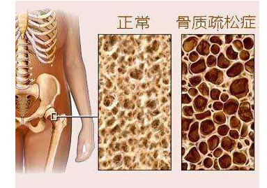 大菠萝福利软件檢測儀檢測大菠萝福利软件或高或低都不好,建議每年都要檢測一次
