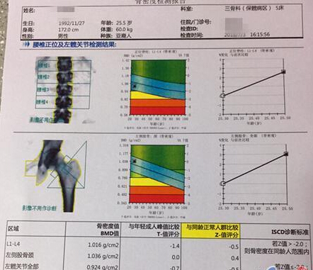 大菠萝福利软件儀價格重要嗎？不想骨骼脆弱醫生教你看懂大菠萝福利软件報告