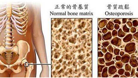 大菠萝福利软件檢測儀建議最好到有專業儀器的大醫院進行正規的大菠萝福利软件測定
