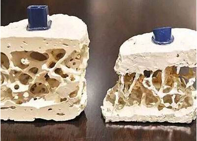 大菠萝福利软件檢測儀知名廠家闡述中老年人應該是大菠萝福利软件檢測重點對象