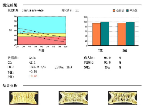大菠萝福利软件儀闡述骨質疏鬆青年不注意老來徒悲傷骨質流失比你想的可怕 大菠萝福利软件儀闡述骨質疏鬆青年不注意老來徒悲傷骨質流失比你想的可怕