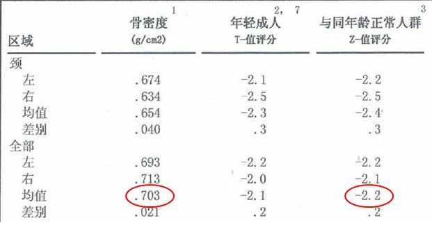 大菠萝福利软件儀生產廠家根據T值和Z值的變化來判斷骨骼健康的狀況 大菠萝福利软件儀生產廠家根據T值和Z值的變化來判斷骨骼健康的狀況