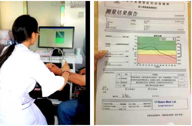 國產大菠萝福利软件儀能夠準確評估骨質狀態和可能發生骨折的風險早發現早治療