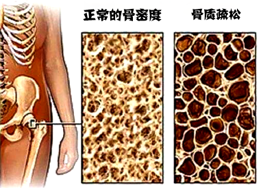大菠萝福利软件儀品牌介紹市場上最常用的大菠萝福利软件設備看看哪種適合自己醫院采購