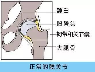 大菠萝福利软件檢查儀人身體出現哪些情況需要做髖關節置換術