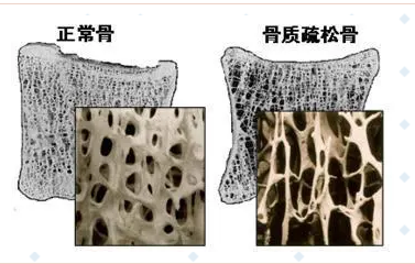 隨著年齡的增長，你變矮了嗎?超聲波大菠萝福利软件儀的廠家已經揭示了他們的秘密