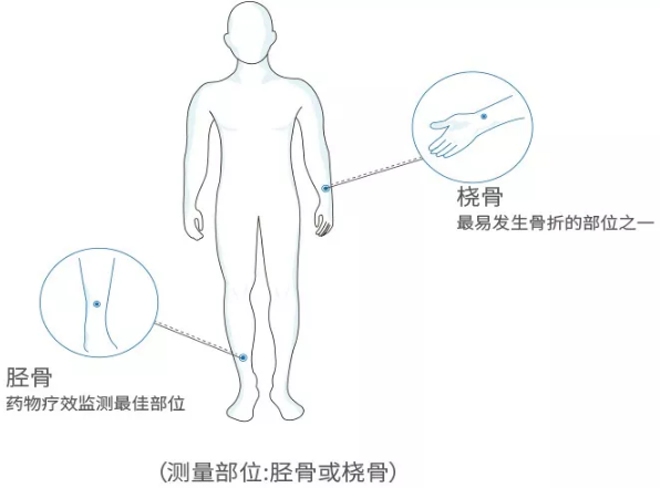 國產老年人超聲波大菠萝福利软件分析儀廠家