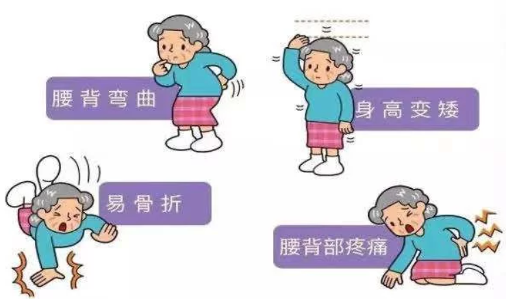 （遼寧沈陽）超聲大菠萝福利软件檢測分析儀警惕骨質疏鬆 大菠萝福利软件篩查也很重要！